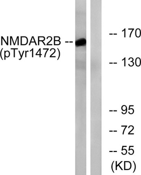 NMDAε2 (phospho Tyr1474) rabbit pAb