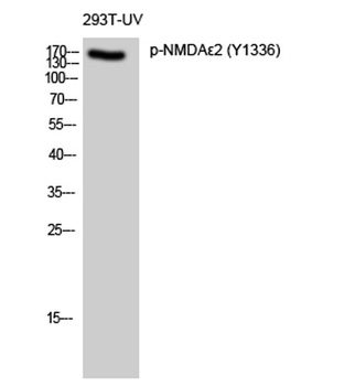 NMDAε2 (phospho Tyr1336) rabbit pAb