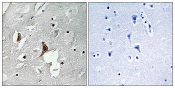 NMDA Epsilon 2 (phospho-Tyr1336) antibody