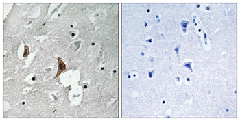 NMDAε2 (phospho Tyr1336) rabbit pAb