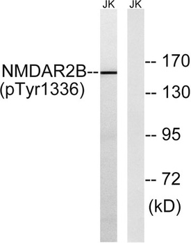 NMDA Epsilon 2 (phospho-Tyr1336) antibody
