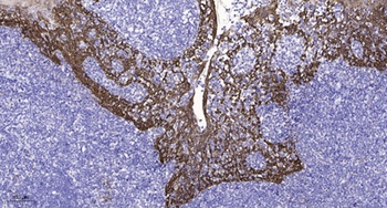 NMDA Epsilon 2 antibody