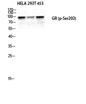 GR (phospho-Ser203) antibody