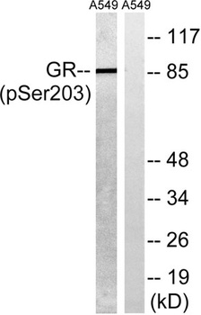 GR (phospho-Ser203) antibody