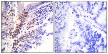 GR (phospho Ser226) rabbit pAb