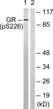 GR (phospho Ser226) rabbit pAb