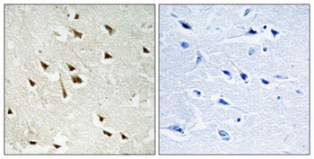 GRF-1 (phospho Tyr1105) rabbit pAb