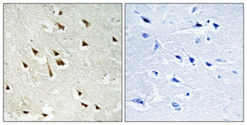 GRF-1 (phospho-Tyr1105) antibody