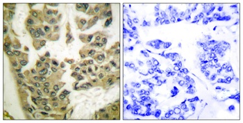 GRF-1 (phospho-Tyr1105) antibody