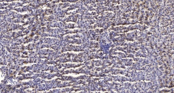 MRP-L22 antibody