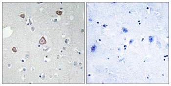 mGluR2 antibody