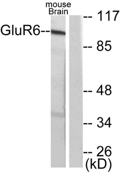 mGluR-6 antibody