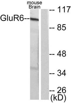 mGluR-6 rabbit pAb