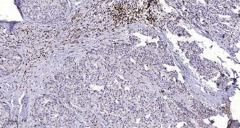 mGluR7 antibody