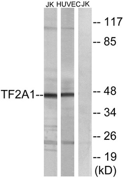 TFIIA-alpha antibody