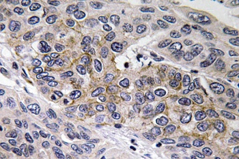 GCS-β-2 rabbit pAb Antibody