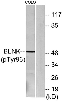 BLNK (phospho Tyr96) rabbit pAb
