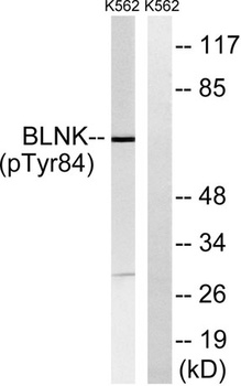 BLNK (phospho Tyr84) rabbit pAb