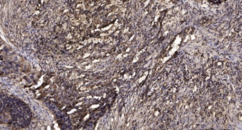 Mic-1 rabbit pAb Antibody