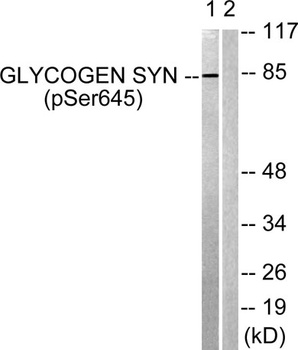 Glycogen Synthase 1 (phospho-Ser645) antibody
