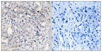 HC-II antibody