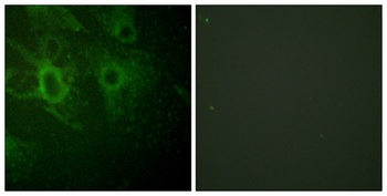 Hck (phospho Tyr410) rabbit pAb