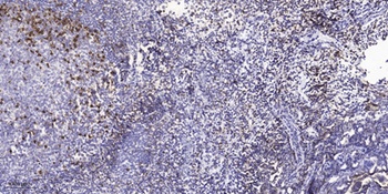 Hck (phospho-Tyr410) antibody