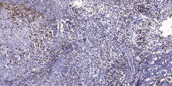 Hck (phospho Tyr410) rabbit pAb
