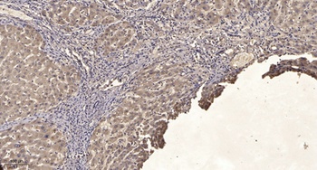 Lck BP-1 (phospho-Tyr397) antibody