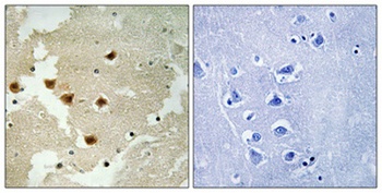 Huntingtin (phospho Ser421) rabbit pAb