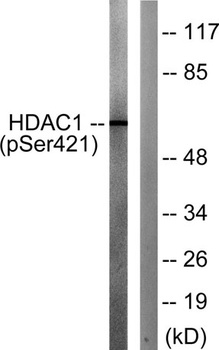 HDAC1 (phospho Ser421) rabbit pAb