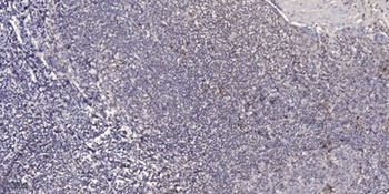 HDAC1 (phospho Ser421) rabbit pAb
