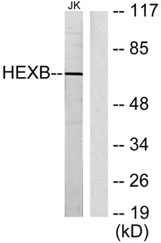 Hexb rabbit pAb