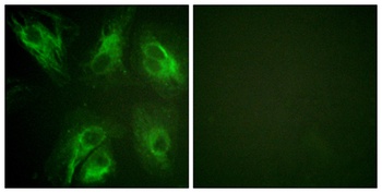 DREAM (phospho Ser63) rabbit pAb