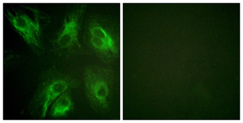 DREAM (phospho-Ser63) antibody