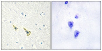 DREAM (phospho Ser63) rabbit pAb