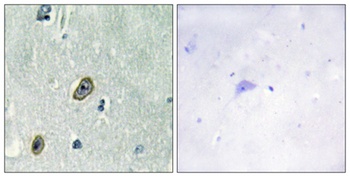 KChIP1 antibody