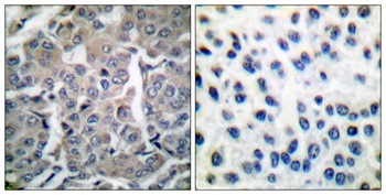 ACC alpha antibody