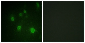 HMG-14 (phospho-Ser21) antibody