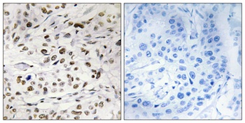 HMG-14 (phospho Ser21) rabbit pAb