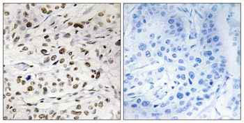 HMG-14 (phospho-Ser21) antibody