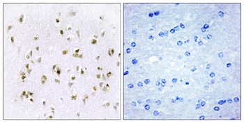 HMG-17 antibody