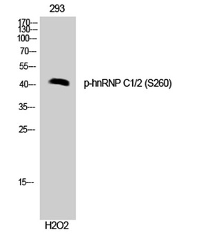 hnRNP C1/2 (phospho Ser260) rabbit pAb Antibody