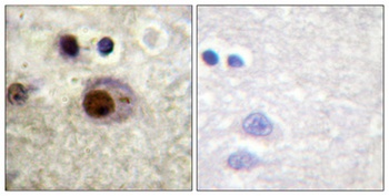 hnRNP C1/2 (phospho Ser260) rabbit pAb