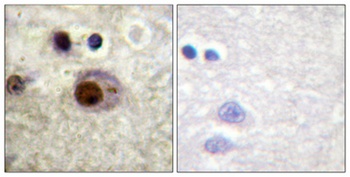 hnRNP C1/2 (phospho-Ser260) antibody