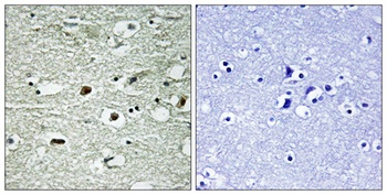 hnRNP C1/2 (phospho Ser260) rabbit pAb