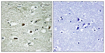 hnRNP C1/2 (phospho-Ser260) antibody