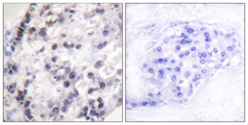 hnRNP C1/2 antibody