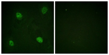 hnRNP D0 (phospho-Ser83) antibody