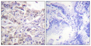 hnRNP D0 (phospho Ser83) rabbit pAb